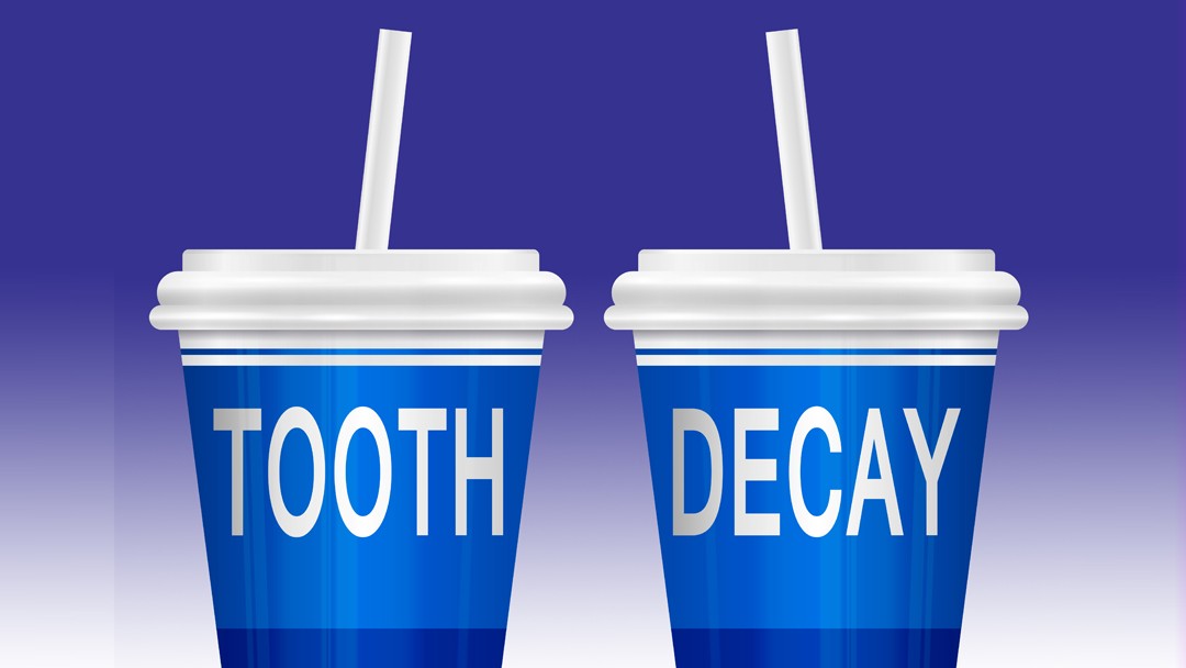 The Impact of Sugary Drinks on Your Teeth