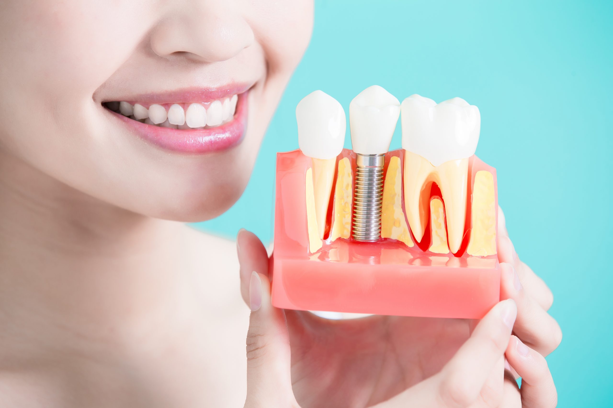 Does it Hurt to Get Dental Implants?
